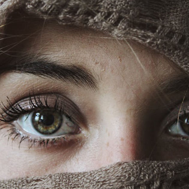 Rosacea